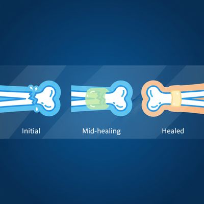 AI-generated image for SAT word disregard