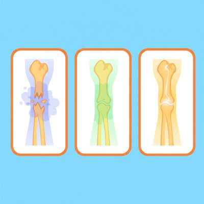 AI-generated image for SAT word malnutrition