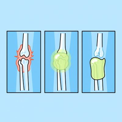 AI-generated image for SAT word obese