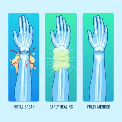 AI-generated image for SAT word resurrection